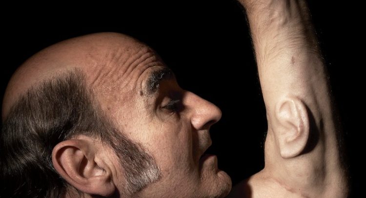 Ear on Arm Stelarc (1)
