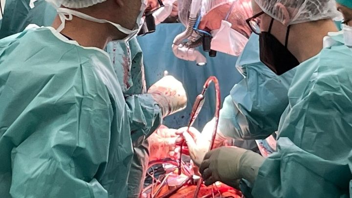 transplantacija na srce