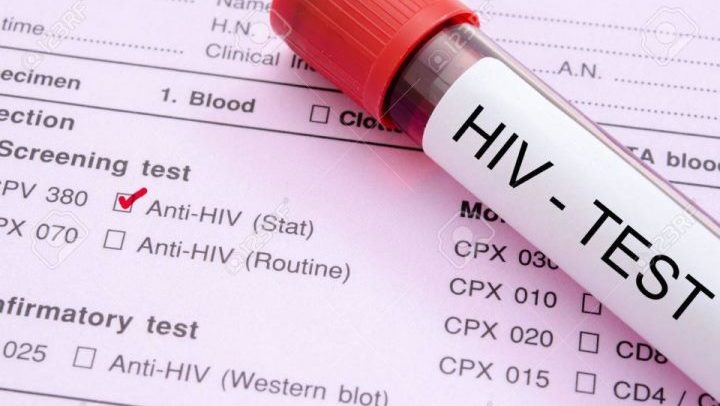 hiv sida